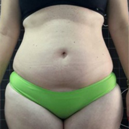 Alugue o aparelho BHS 156